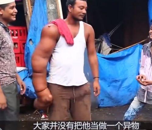 黑臂男网红吃瓜,揭秘网红圈幕后故事